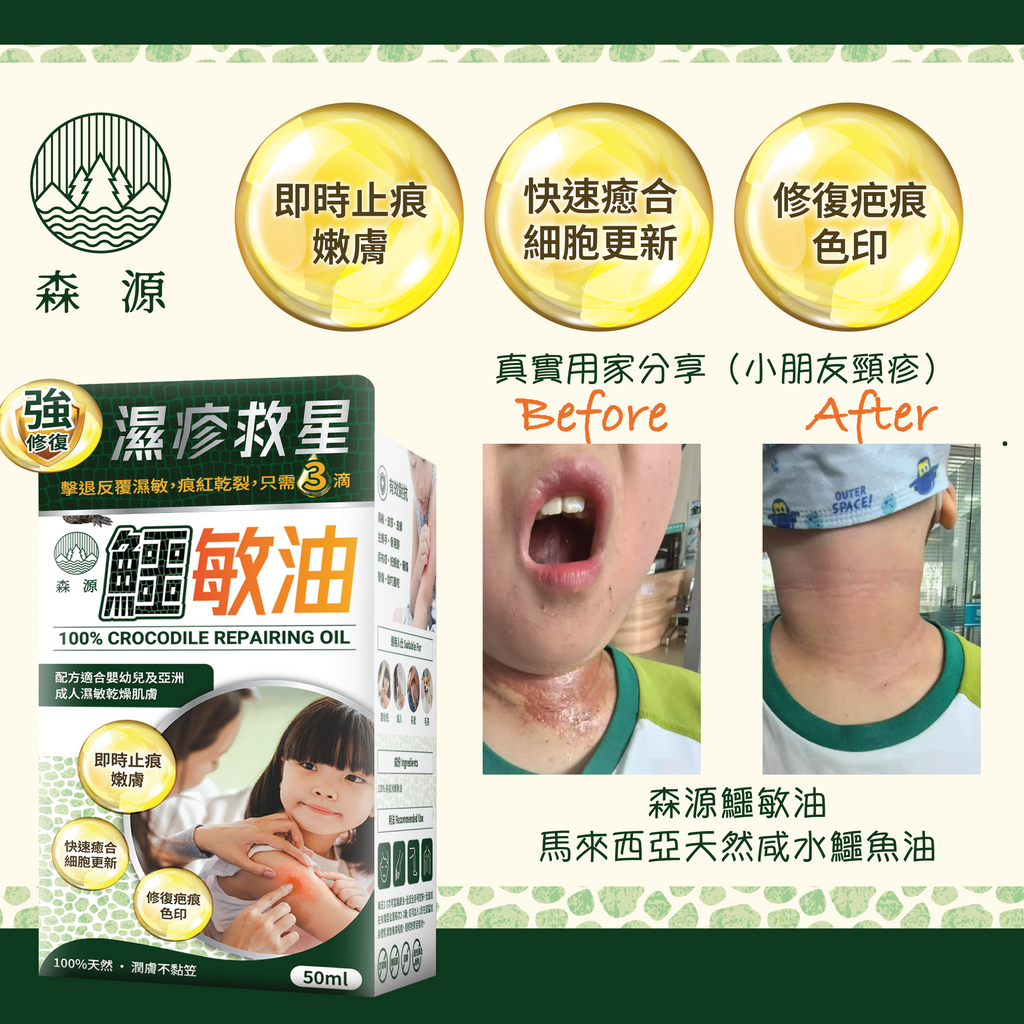 森源 -【濕疹敏感救星】100%天然無類固醇強修復鱷敏油 (50毫升)