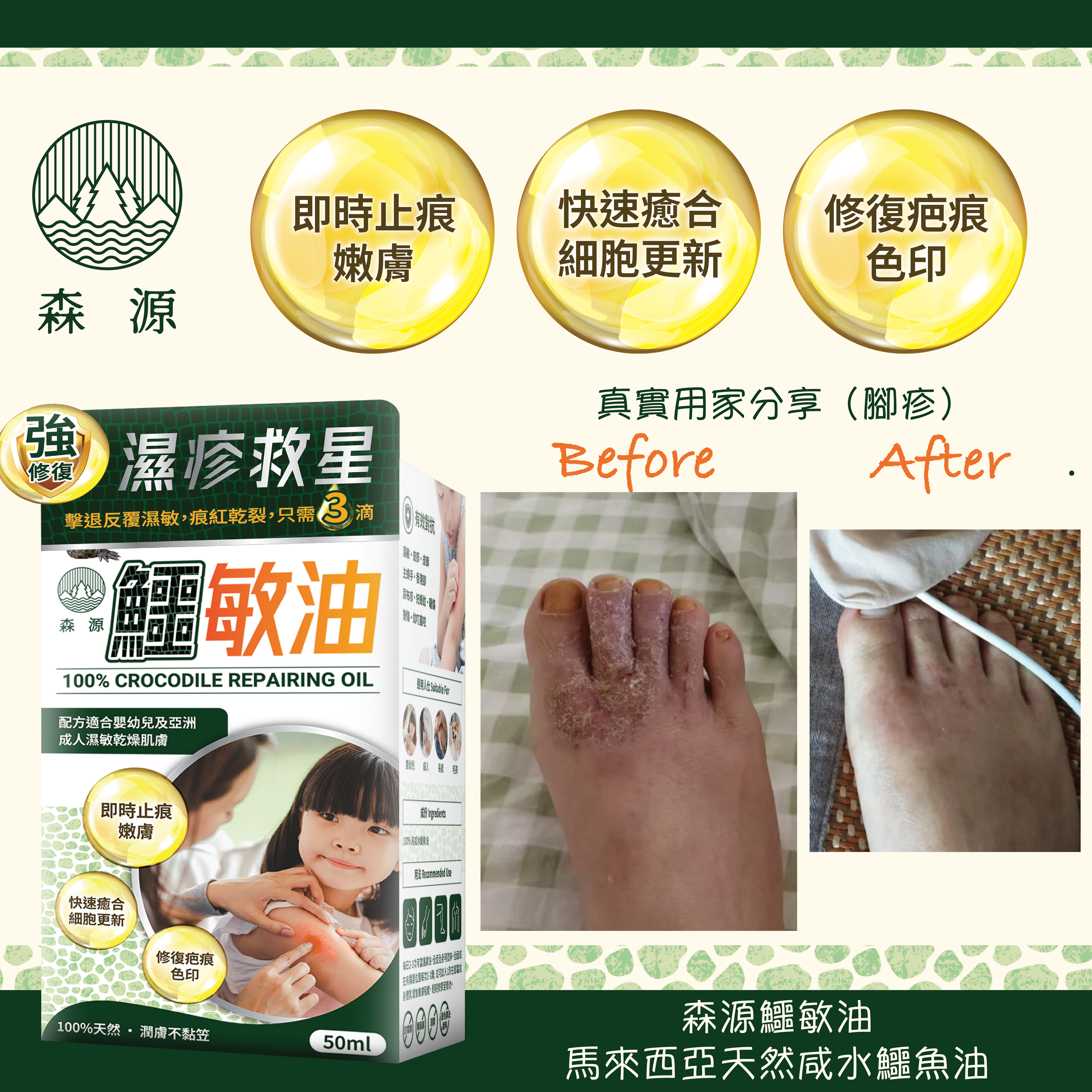 森源 -【濕疹敏感救星】100%天然無類固醇強修復鱷敏油 (50毫升)