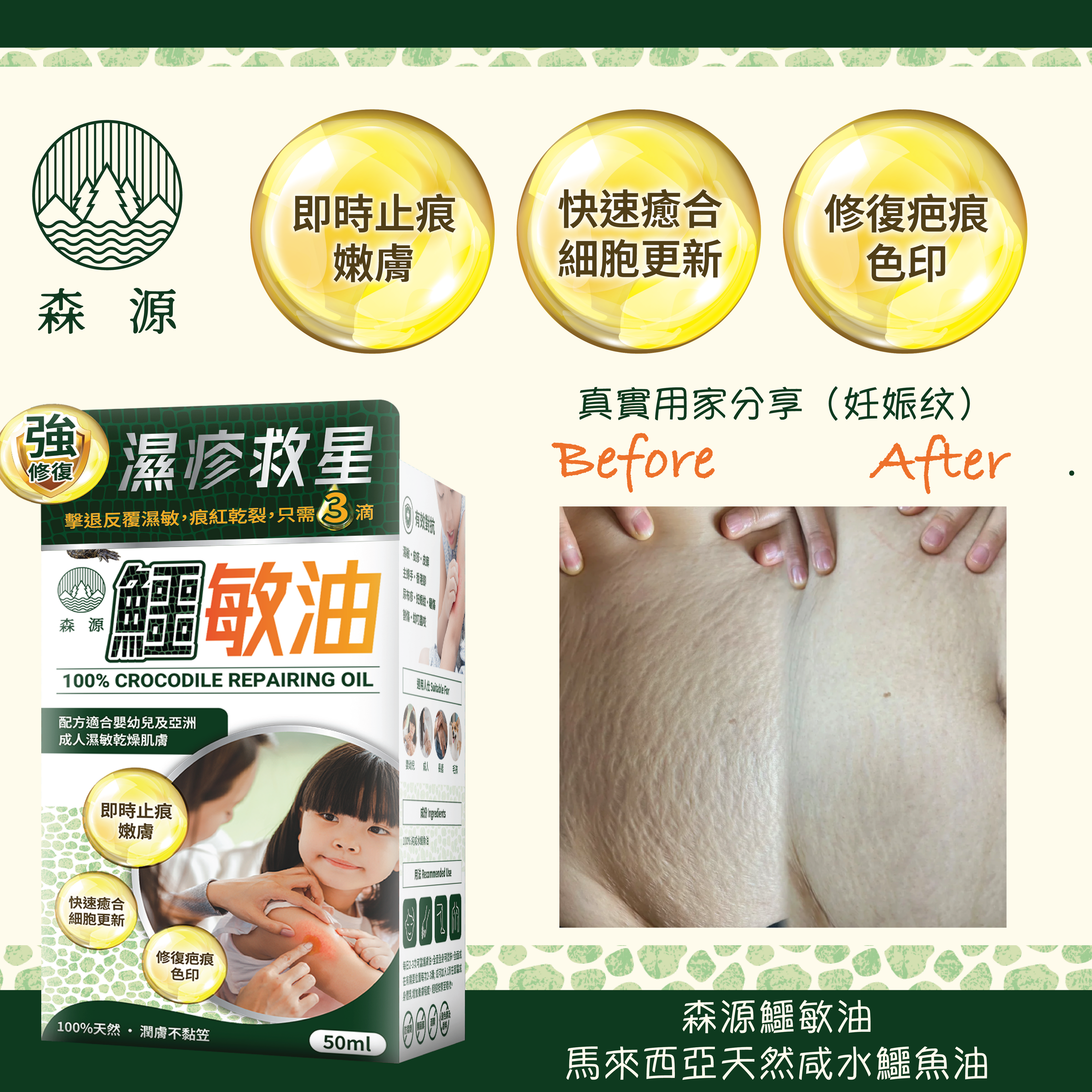 森源 -【濕疹敏感救星】100%天然無類固醇強修復鱷敏油 (50毫升)