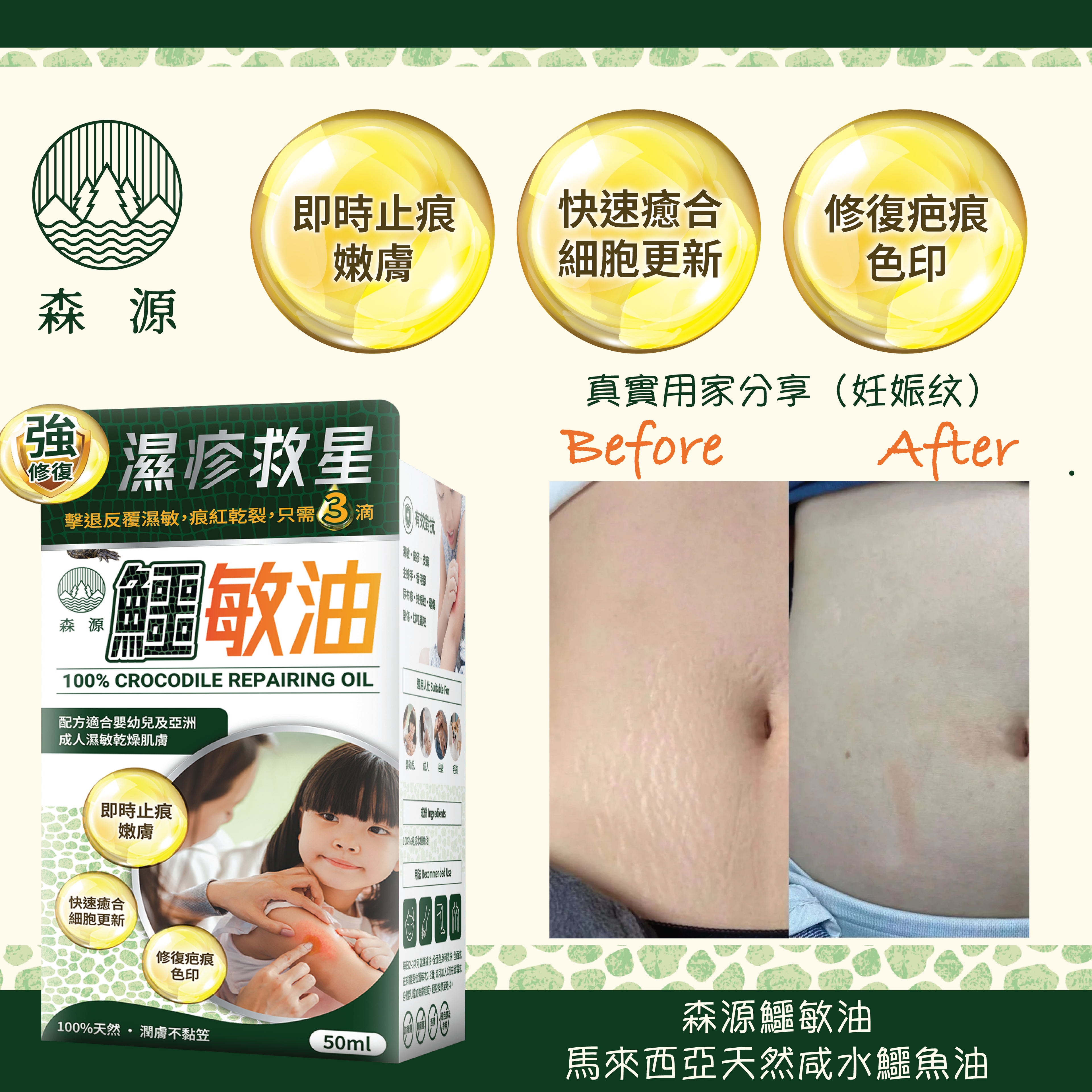 森源 -【濕疹敏感救星】100%天然無類固醇強修復鱷敏油 (50毫升)