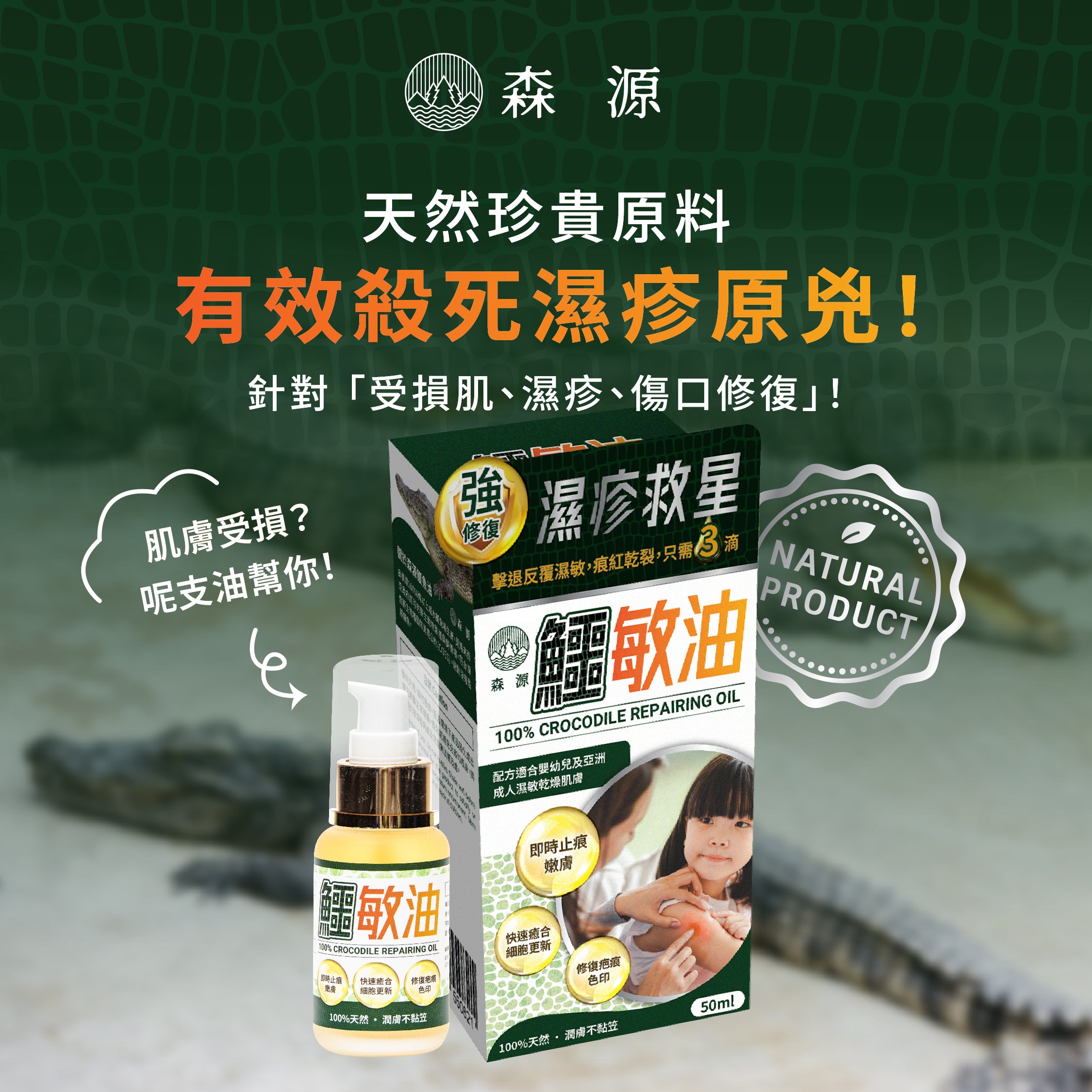 森源 -【濕疹敏感救星】100%天然無類固醇強修復鱷敏油 (50毫升)