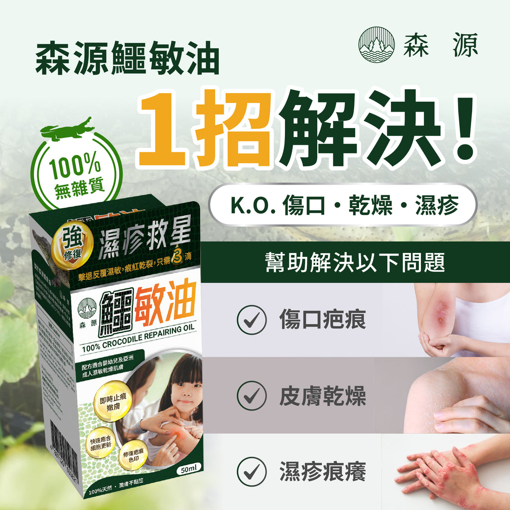 森源 -【濕疹敏感救星】100%天然無類固醇強修復鱷敏油 (50毫升)