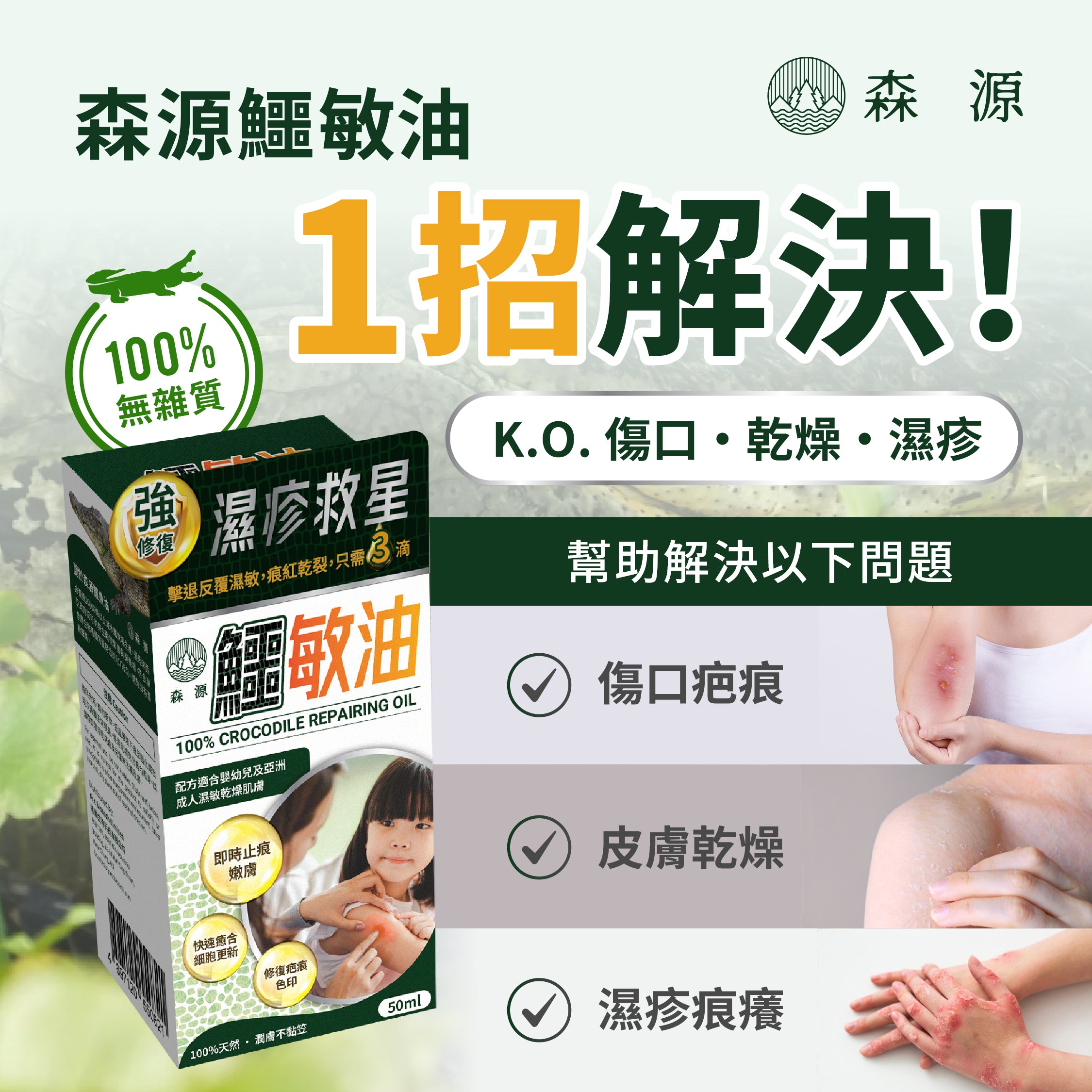 森源 -【濕疹敏感救星】100%天然無類固醇強修復鱷敏油 (50毫升)