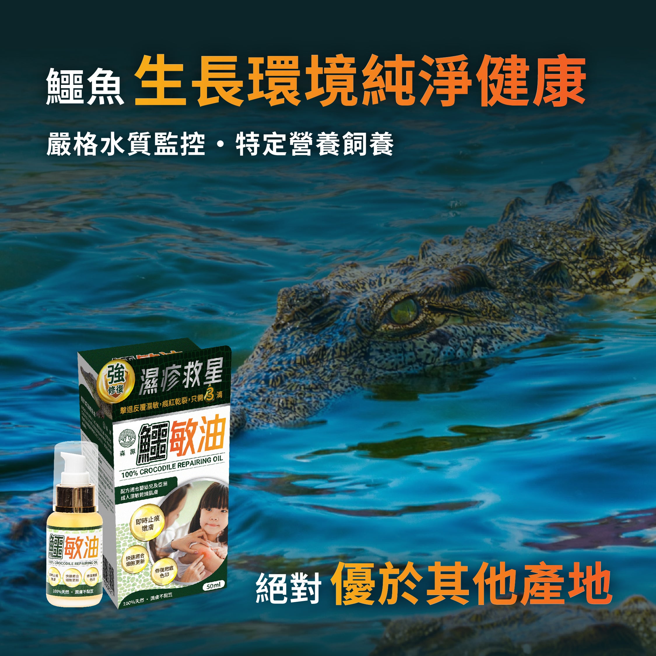 森源 -【濕疹敏感救星】100%天然無類固醇強修復鱷敏油 (50毫升)